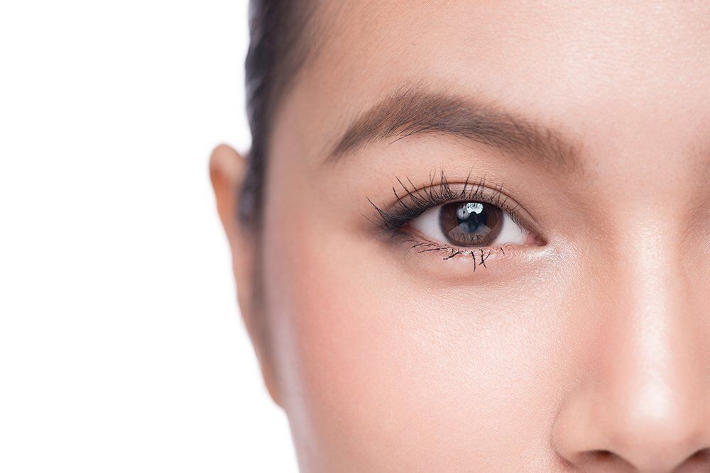 Blepharoplasty